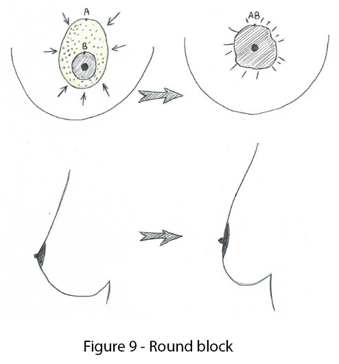 figure 9 : round block